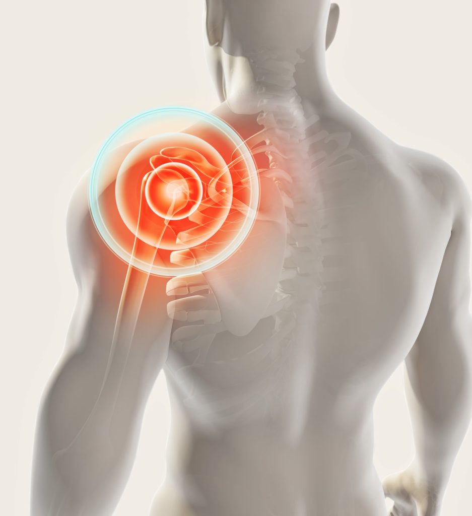 Shoulder and Rotator Cuff Injuries