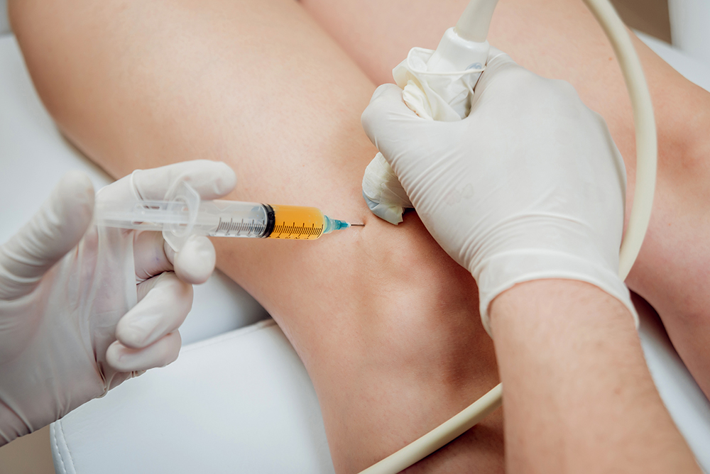 Knee Injection US guided
