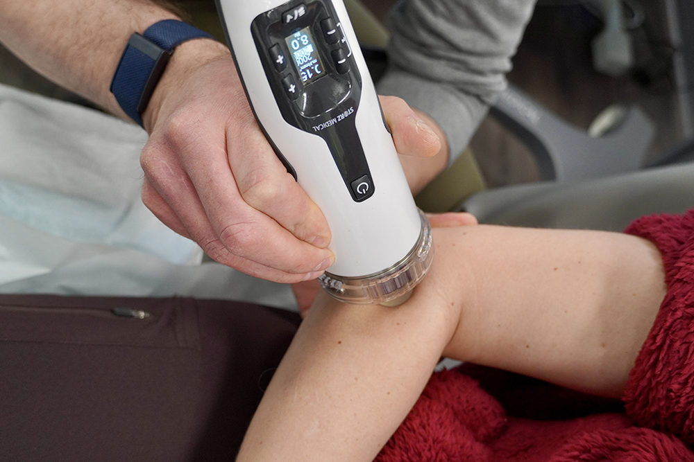 Shock wave therapy