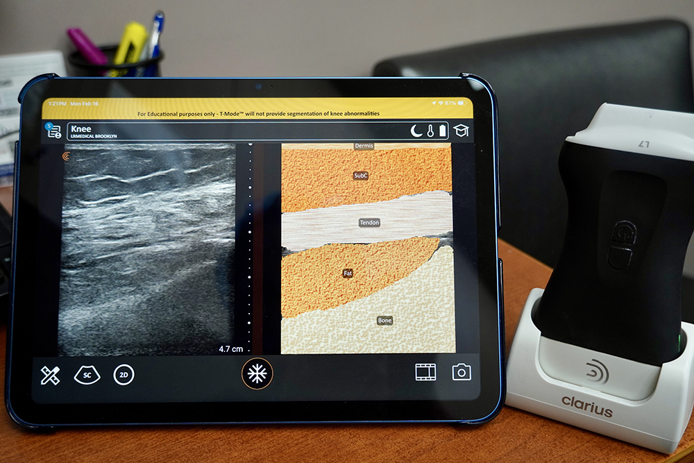 Ultrasound Device