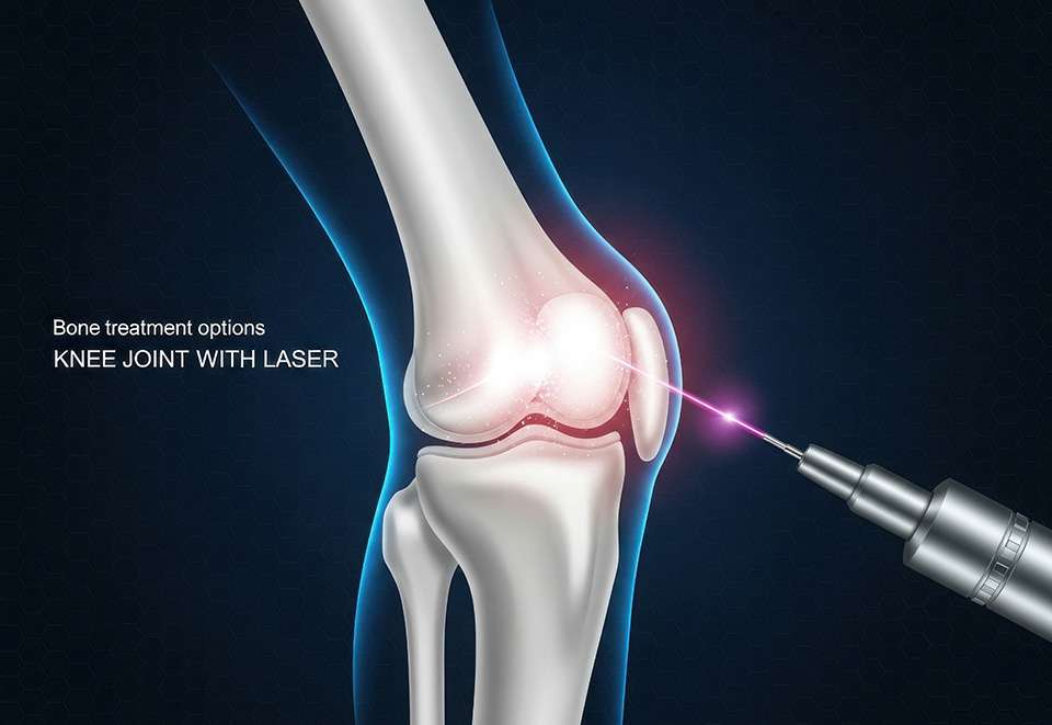 Knee Laser Therapy